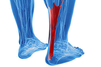 Achilles tendon treatment in San Juan, 00924, Puerto Rico Achilles tendonitis treatment in the San Juan, 00924, Puerto Rico area