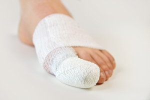 The Basics of Broken Toes